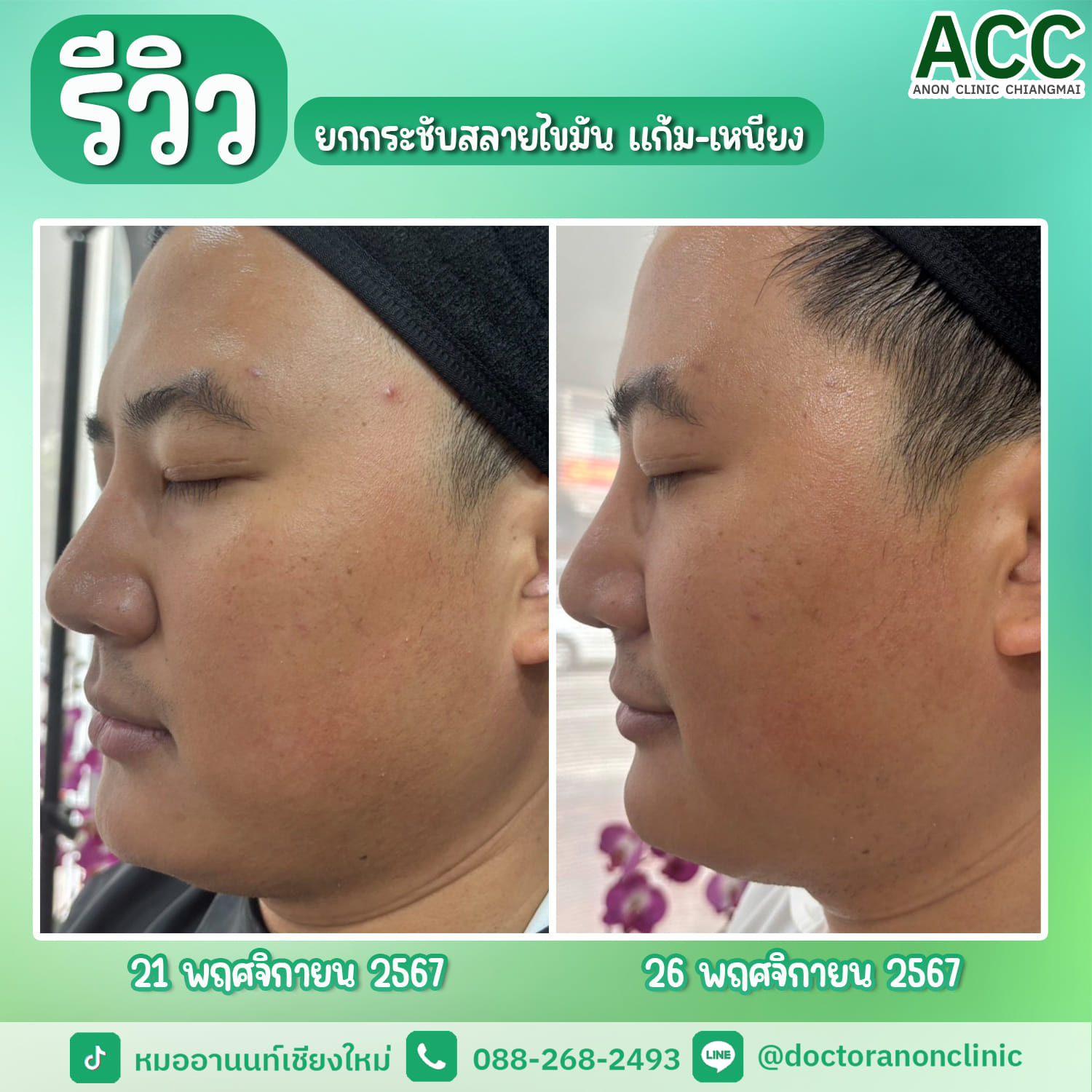 494633300_1257348436391164_746468120767798709_n