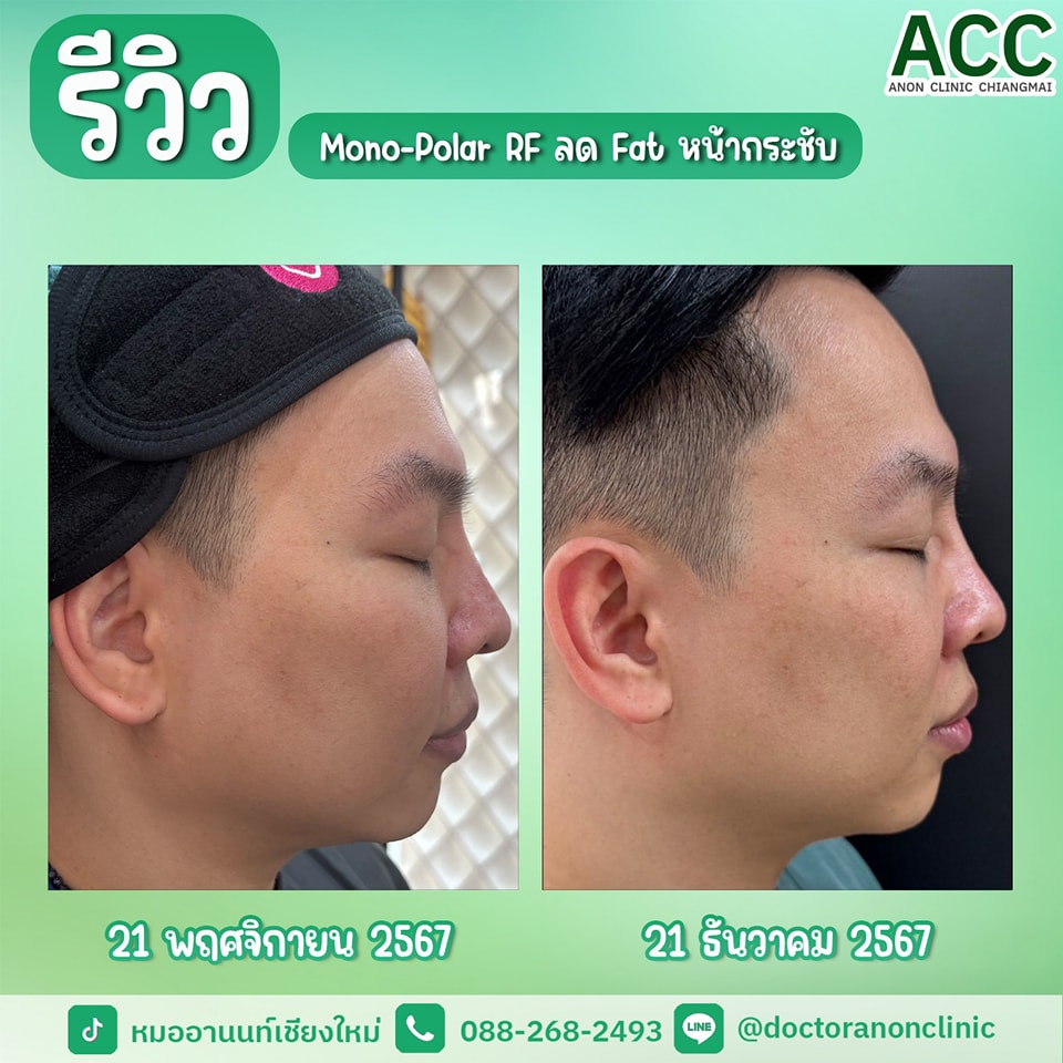 494733501_1258213152971359_4407098988601493465_n