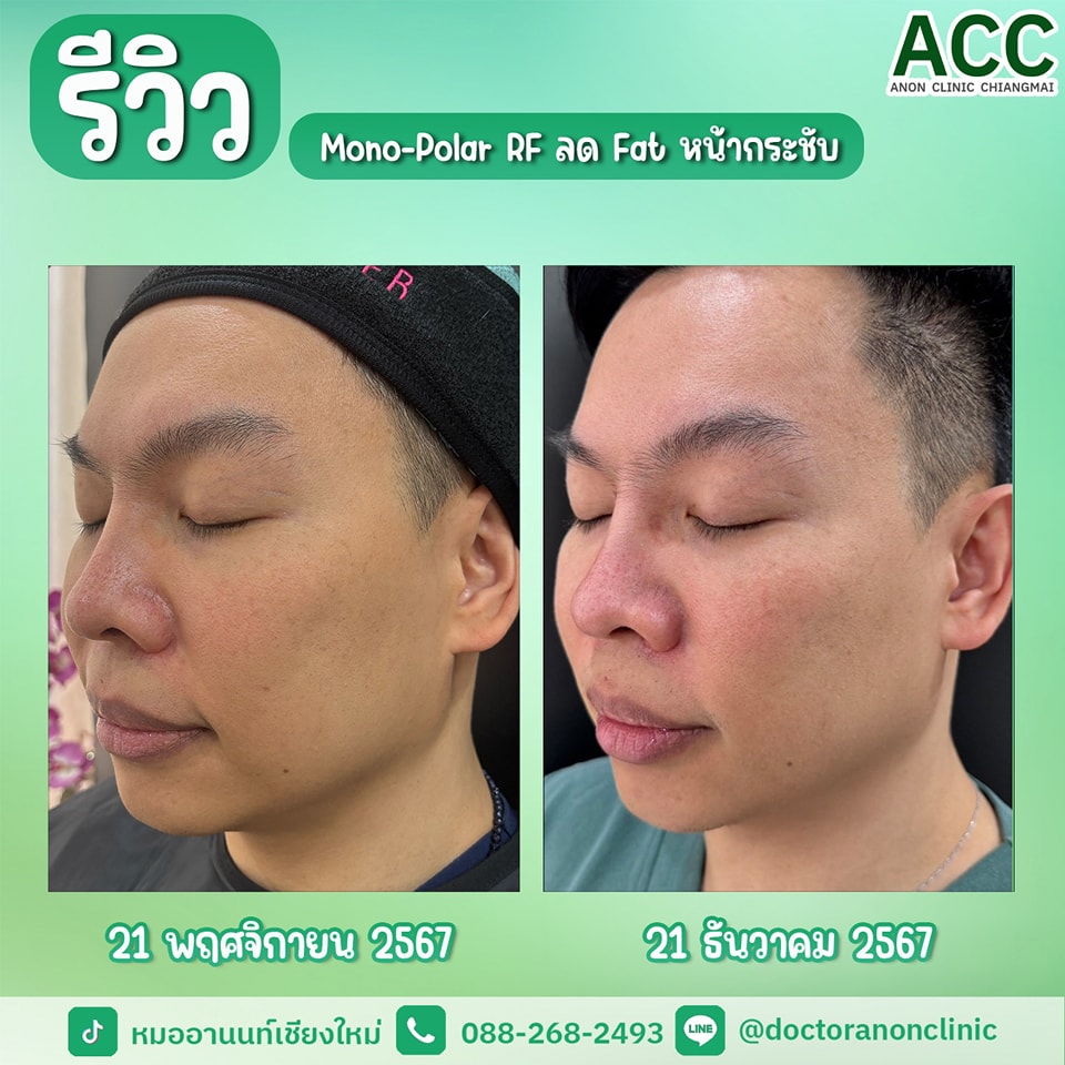 494789948_1258213006304707_4408666537142343980_n