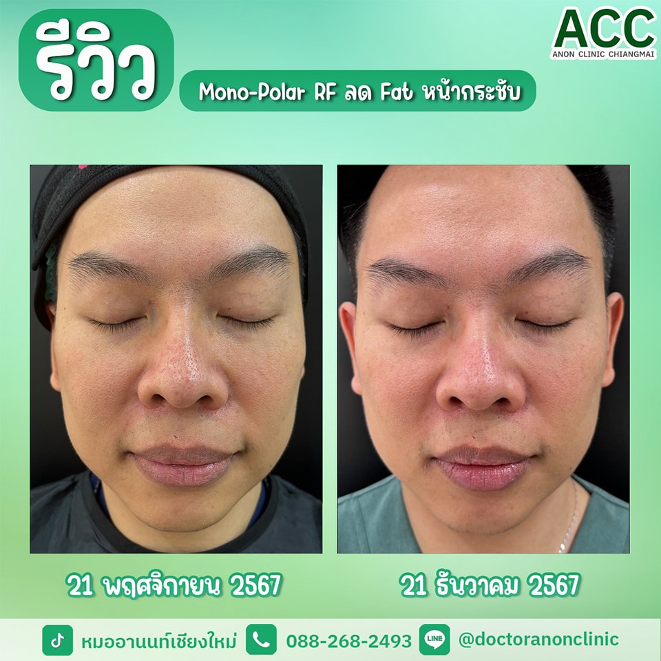 495091419_1258213149638026_9140542060238219477_n