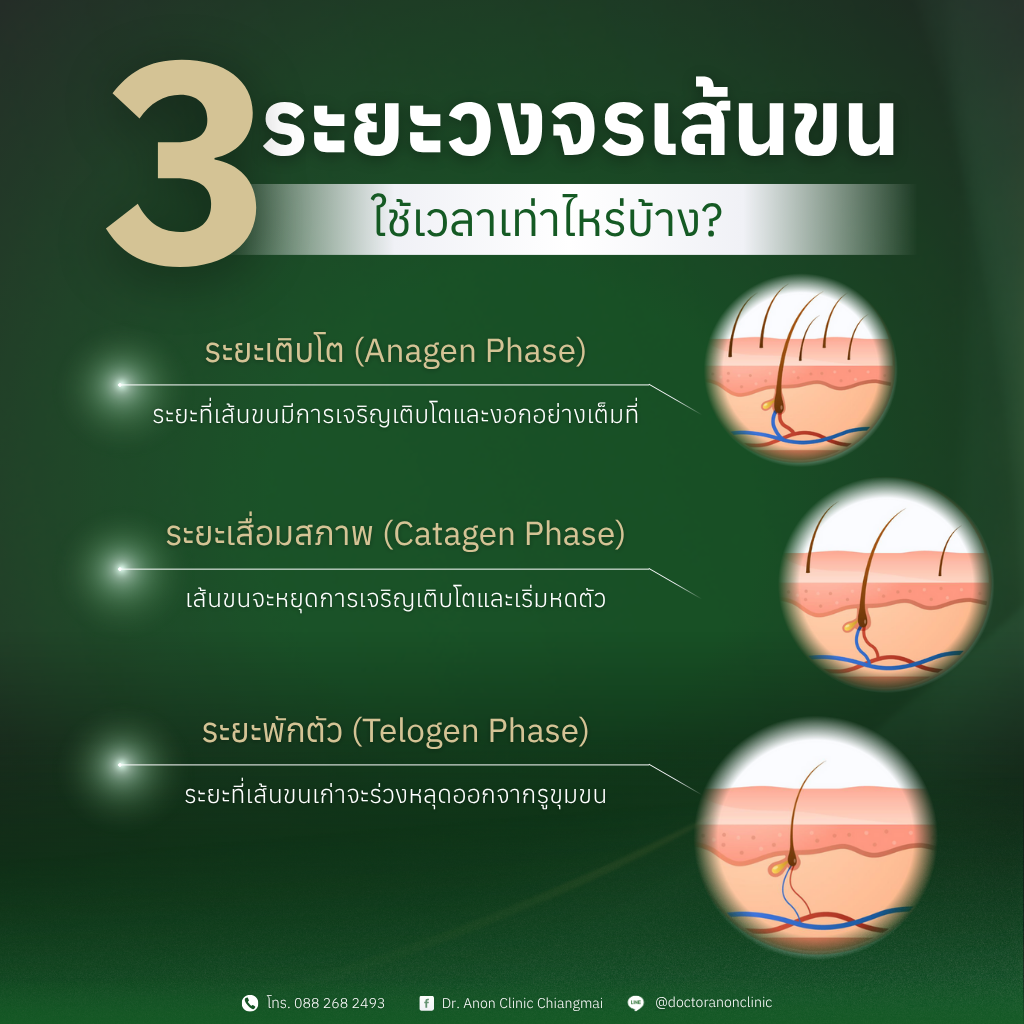 วงจรการเกิดขน และเหตุผลที่ต้องทำเลเซอร์กำจัดขนหลายครั้ง เลเซอร์กำจัดขน เชียงใหม่ Anon Clinic