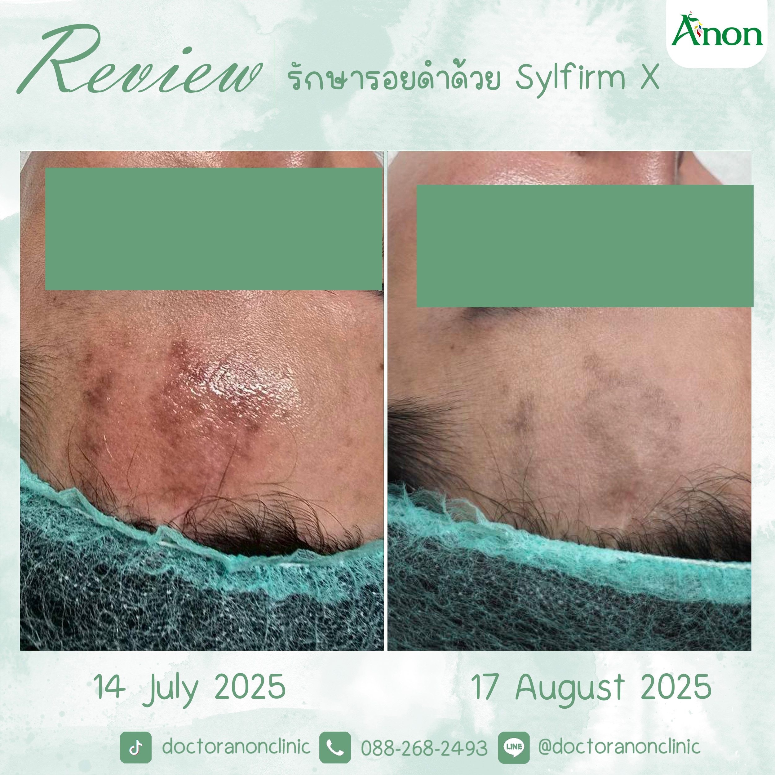 BFAT2025NEWWWWWW-Recovered-Recovered-Recovered-Recovered-Recovered-Recovered-Recovered-Recovered-Recovered-Recovered