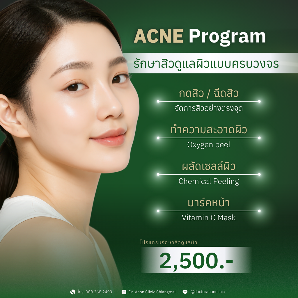 โปรแกรมรักษาสิว ดูแลผิวแบบครบวงจร