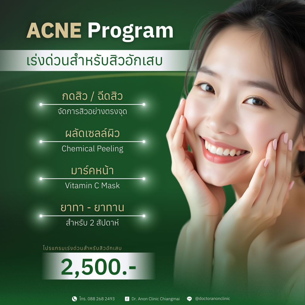 โปรแกรมรักษาสิว โปรแกรมเร่งด่วนสำหรับสิวอักเสบ