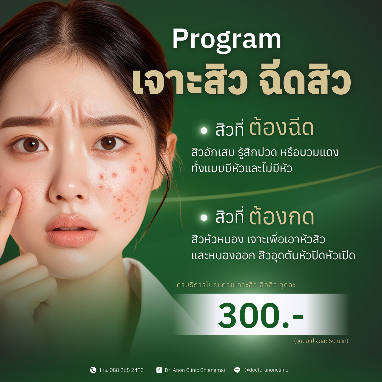 โปรแกรมเจาะสิว ฉีดสิว เชียงใหม่