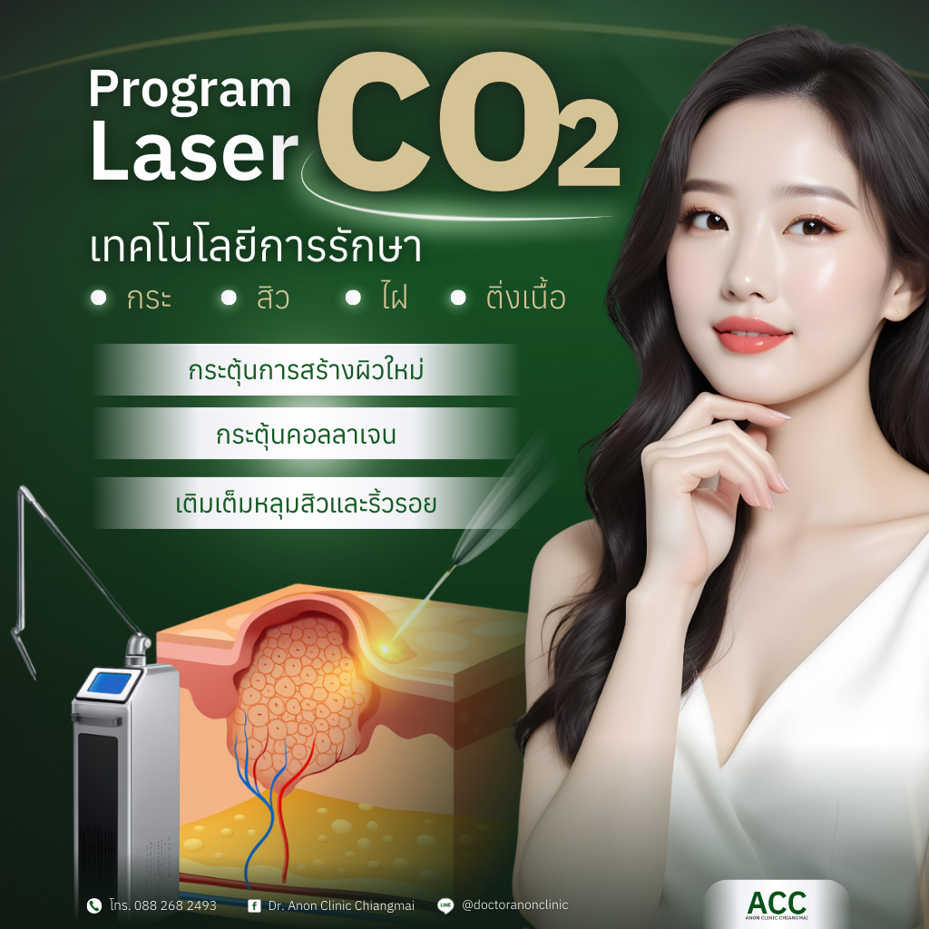 โปรแกรมเลเซอร์ CO2