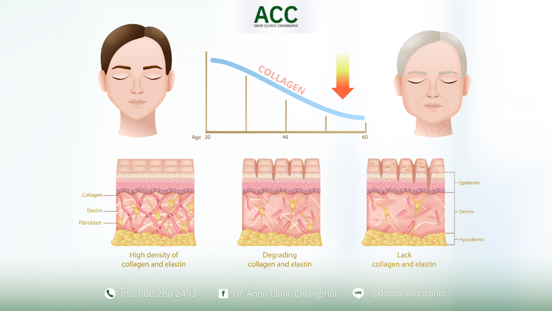 การลดลงของคอลลาเจนและอีลาสตินตามวัย เป็นสาเหตุหลักที่ทำให้ผิวเกิดริ้วรอยและหย่อนคล้อย