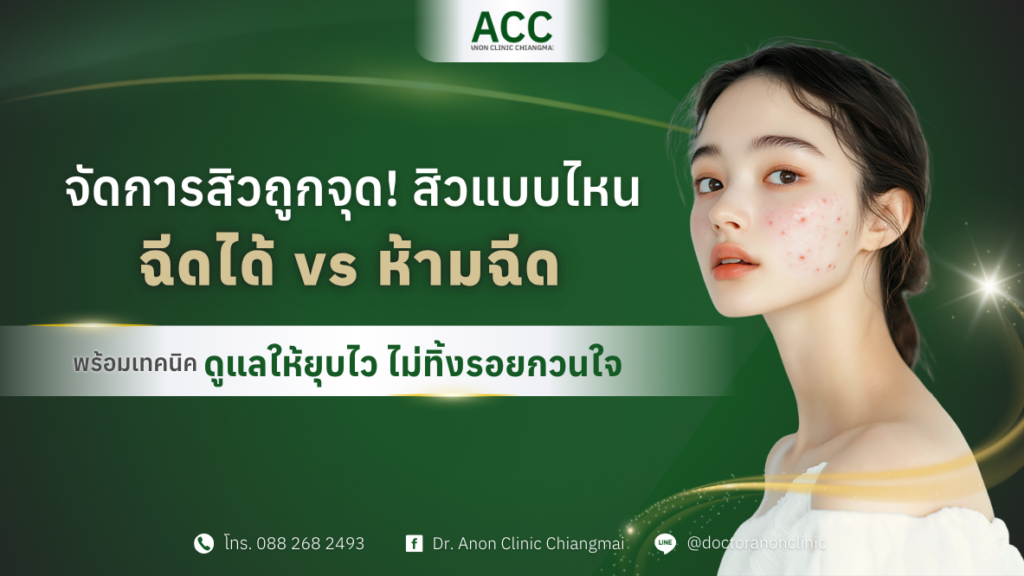 รักษาสิวเชียงใหม่ ฉีดสิวเชียงใหม่