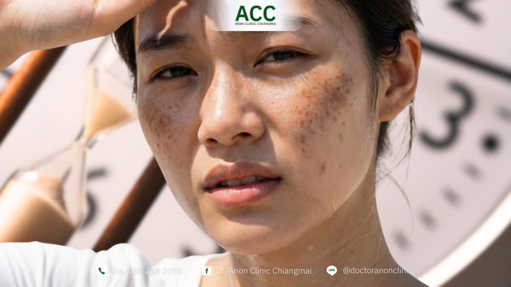 เป็นฝ้าซ้ำๆ ไม่หายสักที