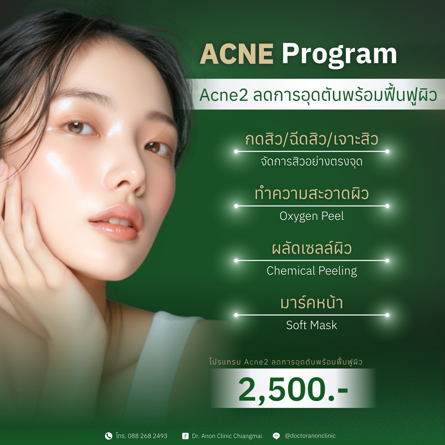 โปรแกรมรักษาสิว acne2 รักษาสิว ดูแลผิวหลังรักษา