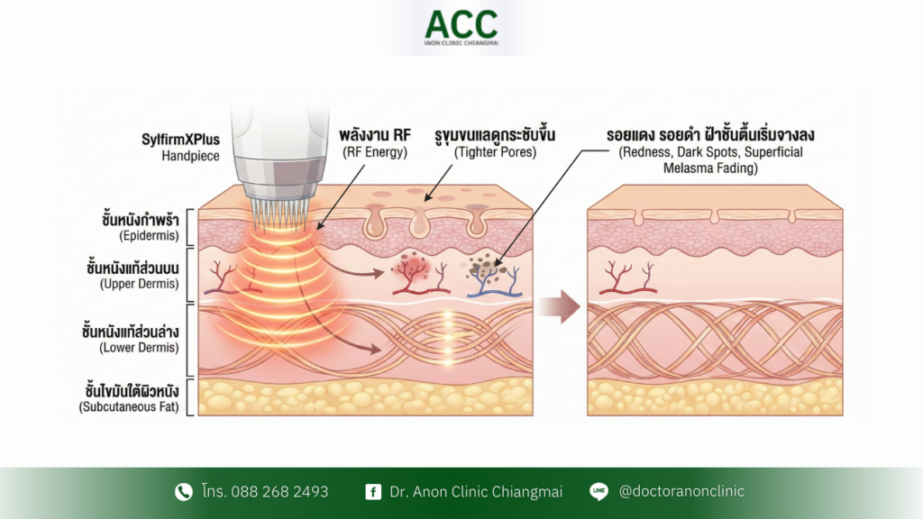 sylfirm-x-plus-skin-roadmap-steps-care-1
