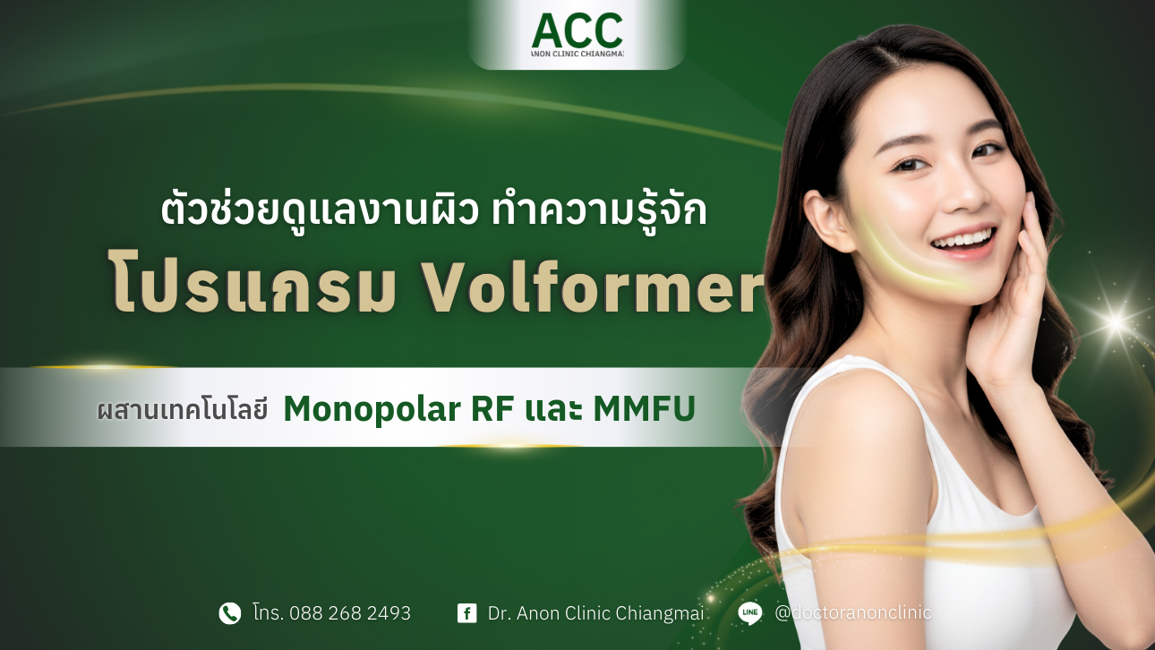 โปรแกรม volformer